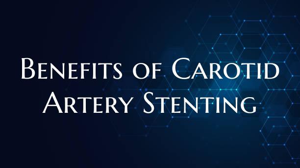 Benefits of Carotid Artery Stenting