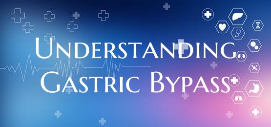Understanding Gastric Bypass