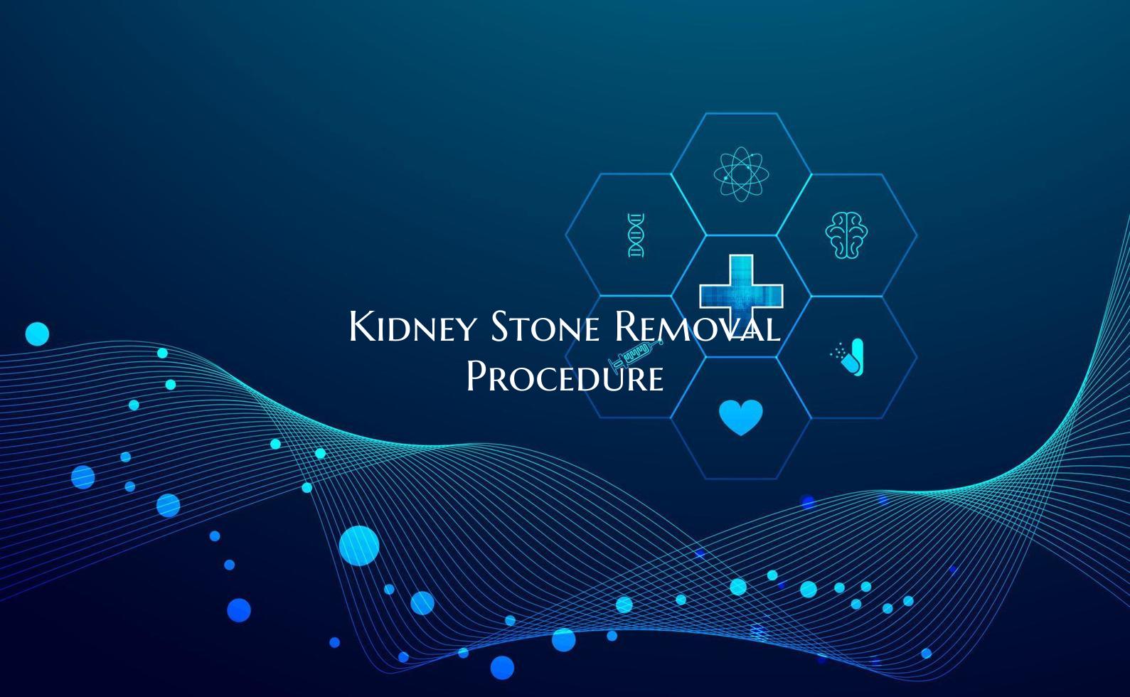 Kidney Stone Removal Procedure