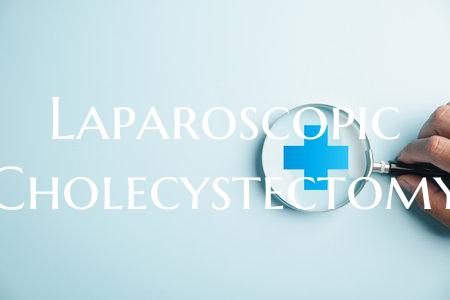Laparoscopic Cholecystectomy