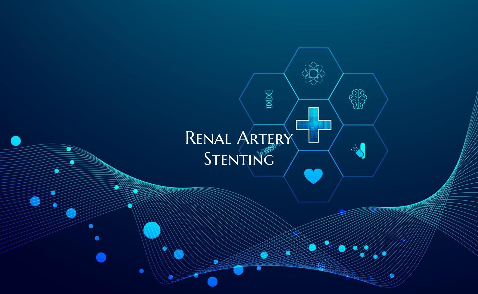 Renal Artery Stenting